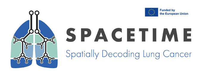 Spatially decoding lung cancer